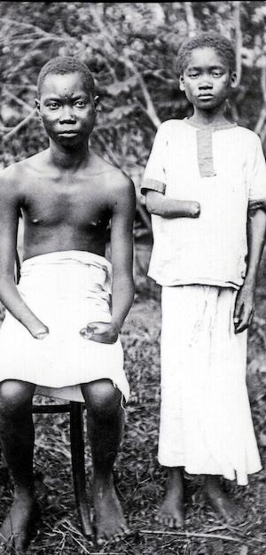 6. Le atrocità coloniali in Congo